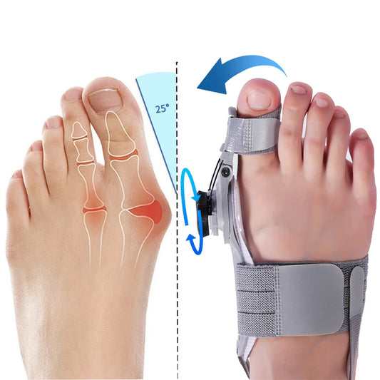 bunion