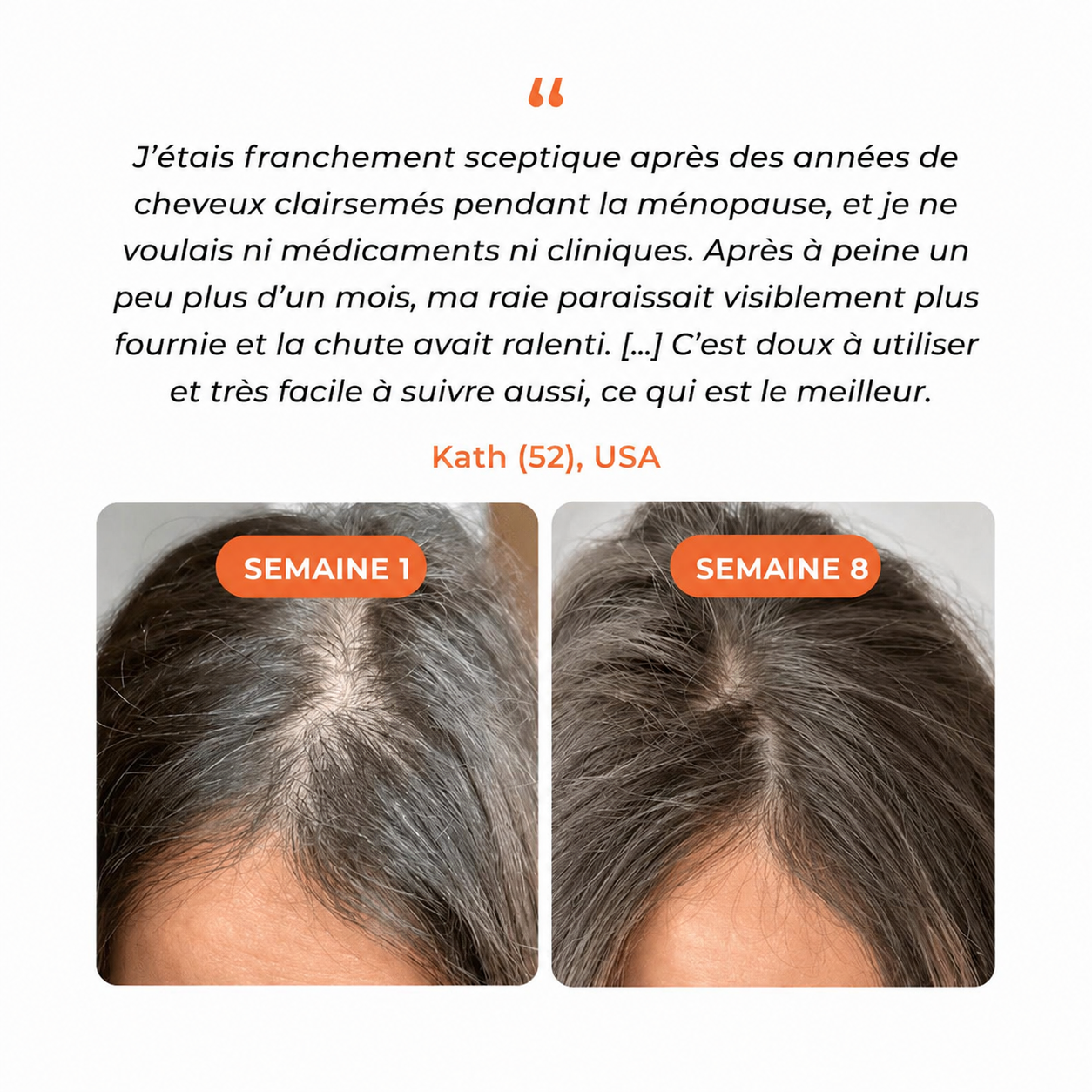 Loryne™ Sérum Croissance Cheveux