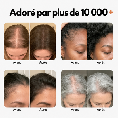 Loryne™ Sérum Croissance Cheveux