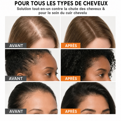 Loryne™ Sérum Croissance Cheveux