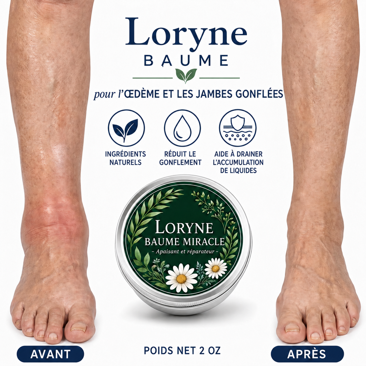 Baume Loryne