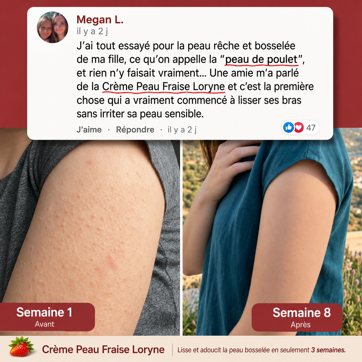 Loryne™ | Crème Anti-Peau de Fraise