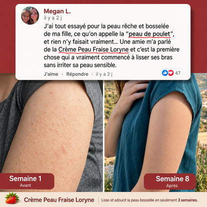 Loryne™ | Crème Anti-Peau de Fraise
