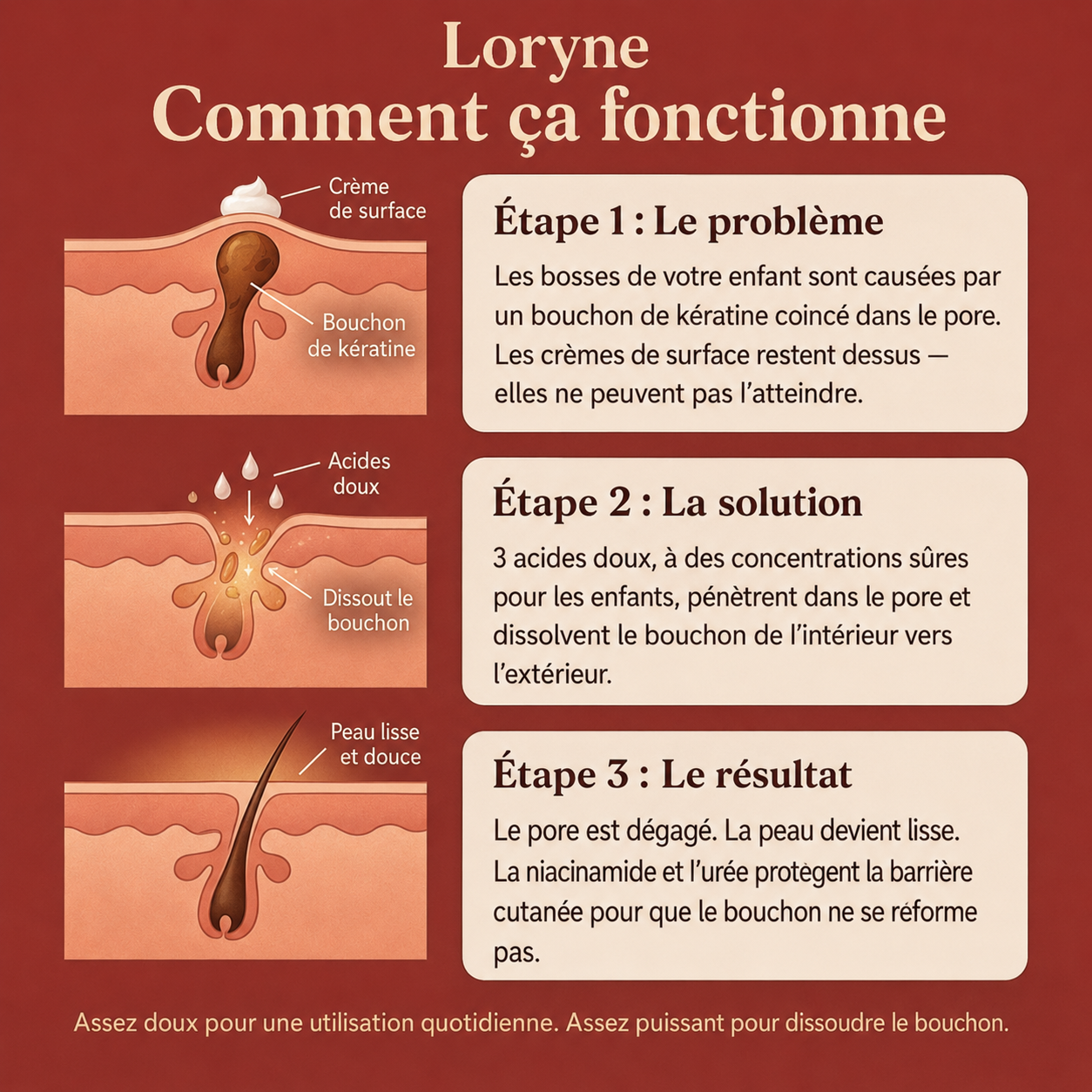 Loryne™ | Crème Anti-Peau de Fraise