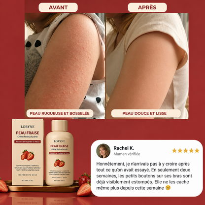 Loryne™ | Crème Anti-Peau de Fraise