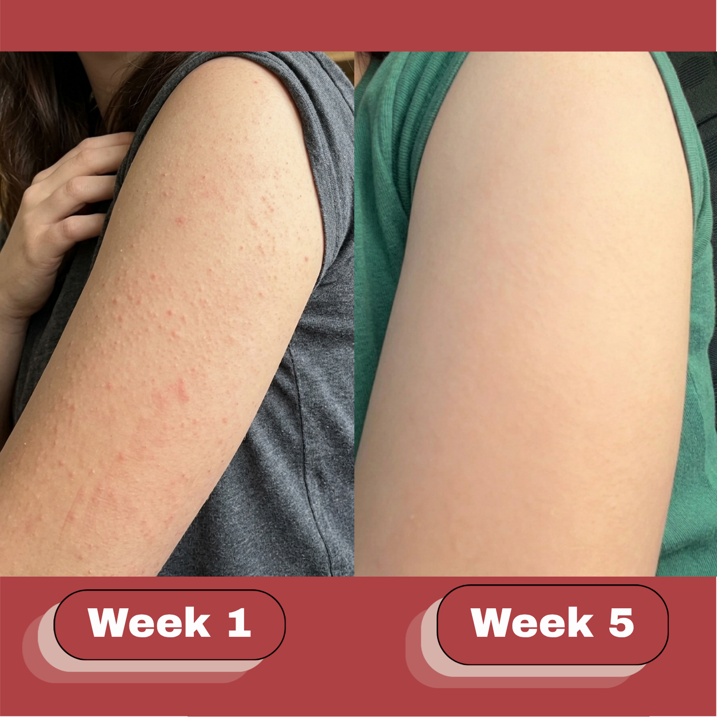 Loryne™ | Crème Anti-Peau de Fraise
