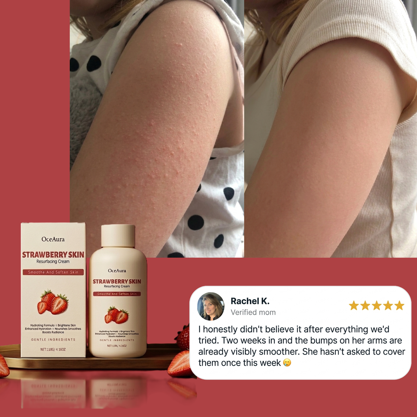 Loryne™ | Crème Anti-Peau de Fraise