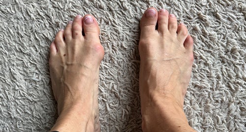 Before and after
