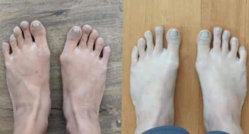 Before and after
