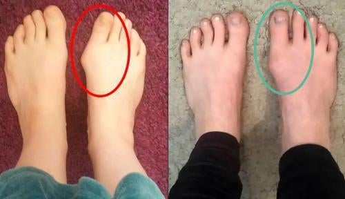Before and after