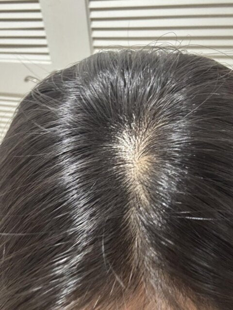 Loryne&trade; Hair Growth Serum
