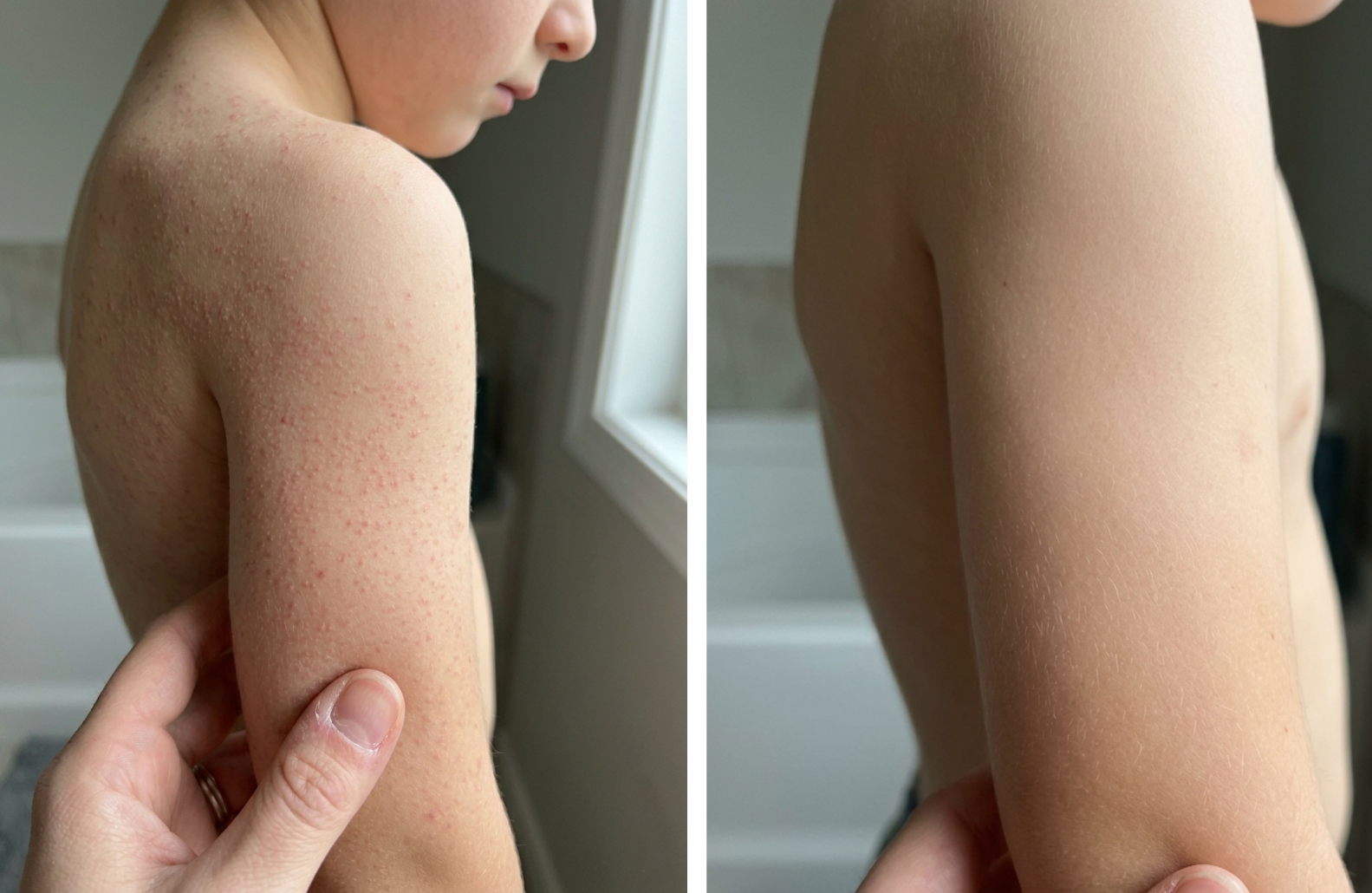 Before and after transformation